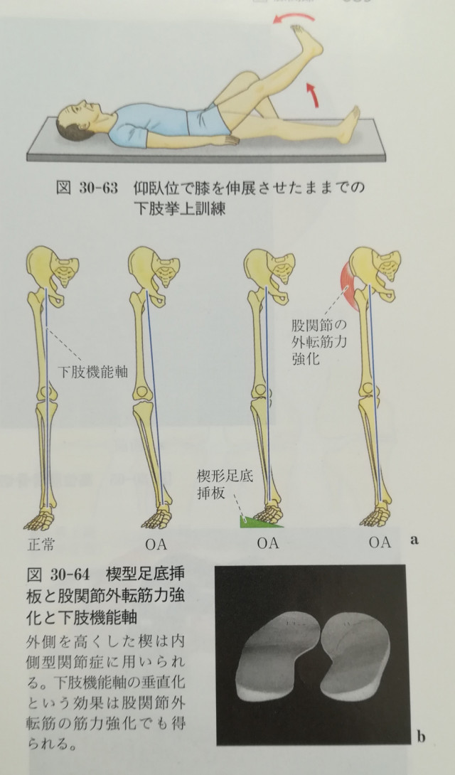 変形性膝関節症の考察