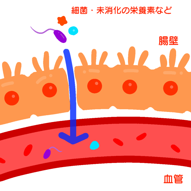 リーキーガット症候群